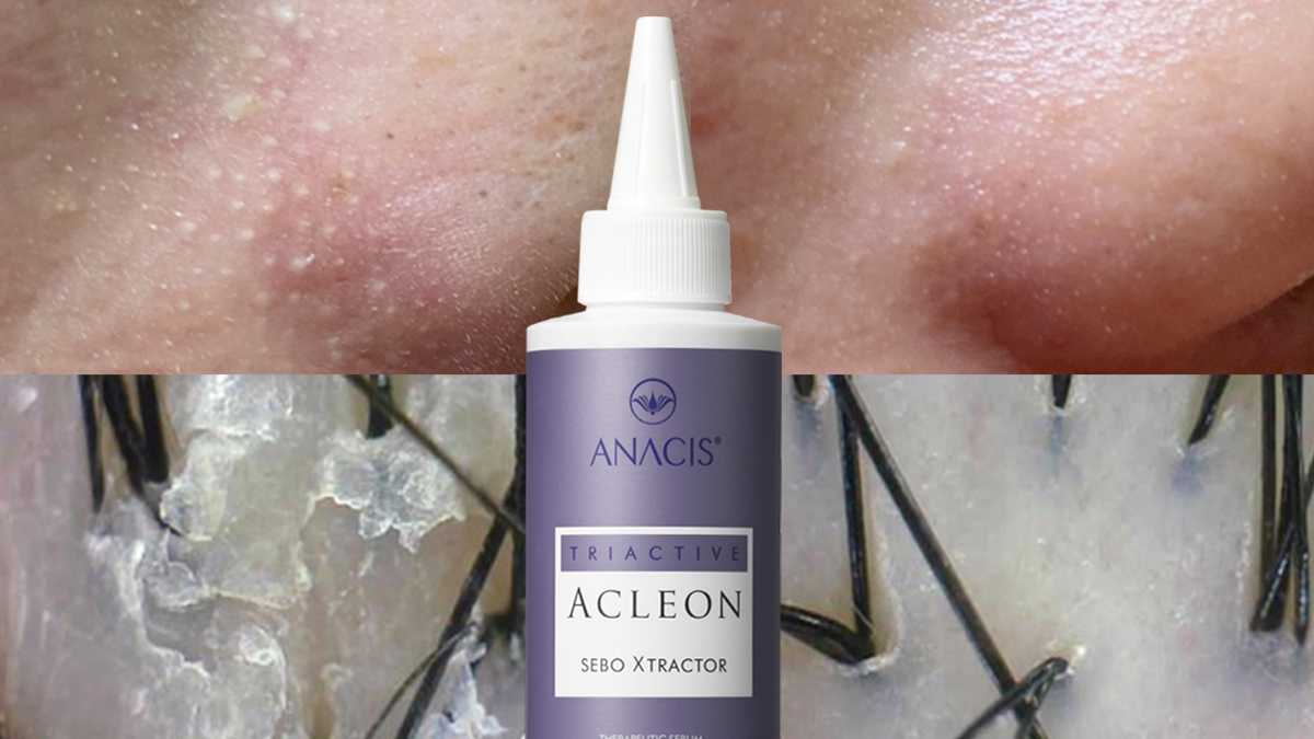 [4차앵콜 ] 올려놓기만 하면 피지, 모공, 두피고민 끝!