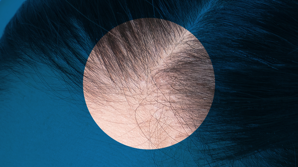 세럼과 샴푸의 신개념 융합ㅣ14년 탈모 전문가가 개발한 기적의 탈모레서피