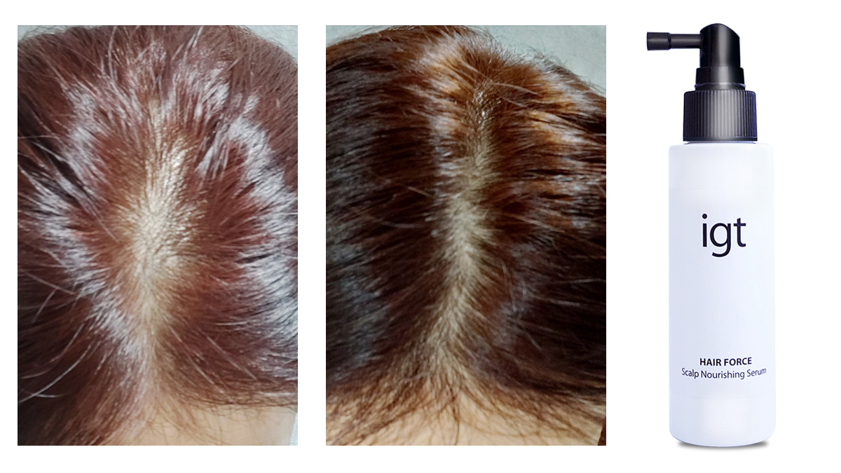 [Hair Force] 头皮抗氧化护理，守护健康头皮 #头皮清洁#头皮降温#发丝营养液