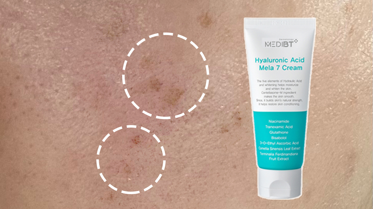 2억앵콜 | 피부 톤이 하얘져야 진짜 미백이지. 뿌리깊은 속기미까지 쏙-