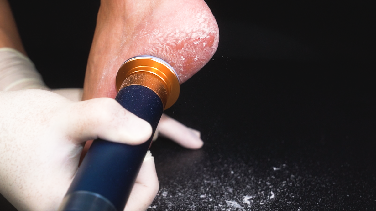 각질 끝장내러 왔습니다. 크리스탈 패드 3종은 처음일껄요?